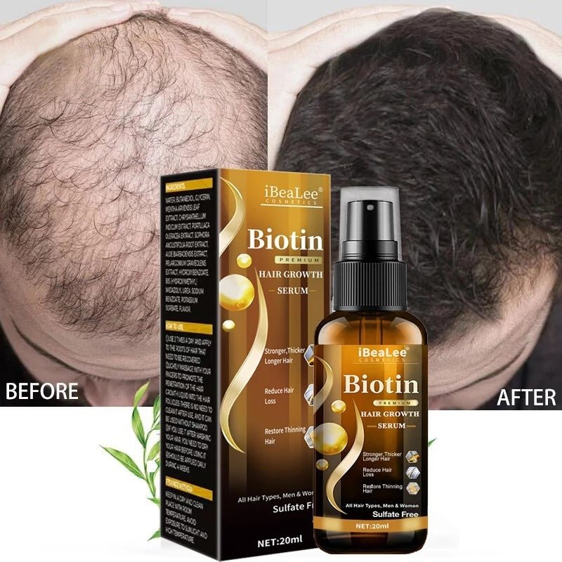 Anti Hair Loss Hair Nourishing Liquid Hair Firming And Hair Increasing - Fiti beautyhaircareCJJY161860001AZ