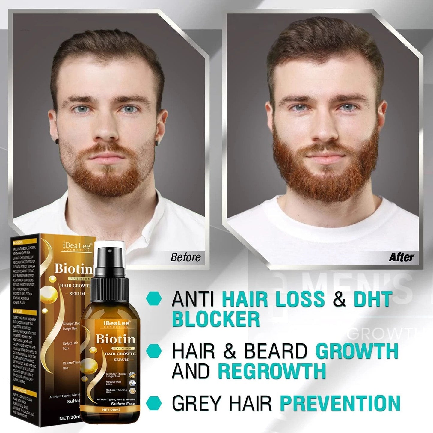 Anti Hair Loss Hair Nourishing Liquid Hair Firming And Hair Increasing - Fiti beautyhaircareCJJY161860001AZ