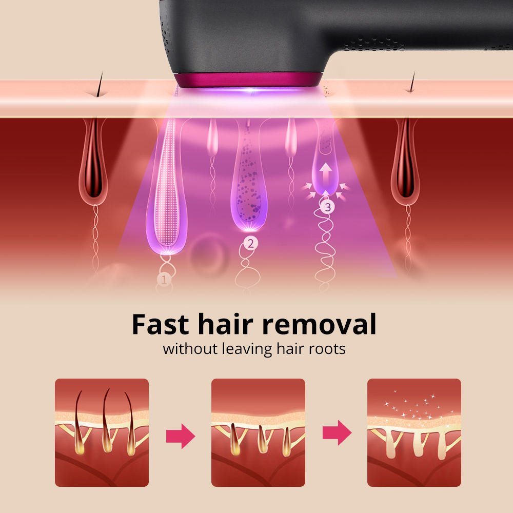 1PCS Laser Hair Removal For Women And Man 100,000 Flashes IPL Painless Laser Hair Removal - Fiti beautyhaircareCJGR192637902BY