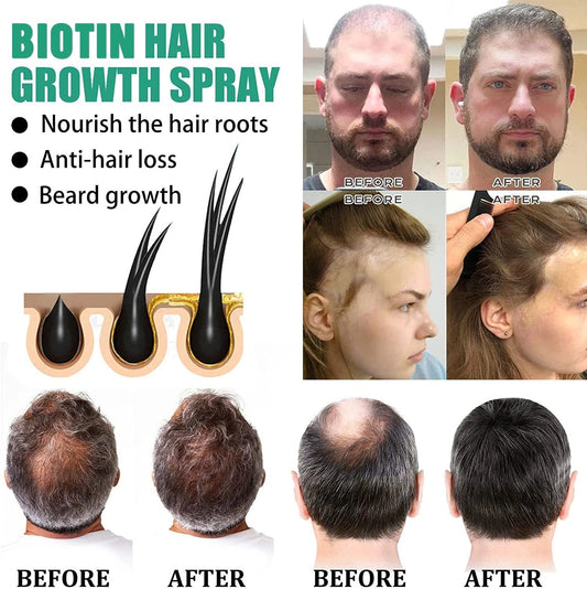 Anti Hair Loss Hair Nourishing Liquid Hair Firming And Hair Increasing - Fiti beautyhaircareCJJY161860001AZ