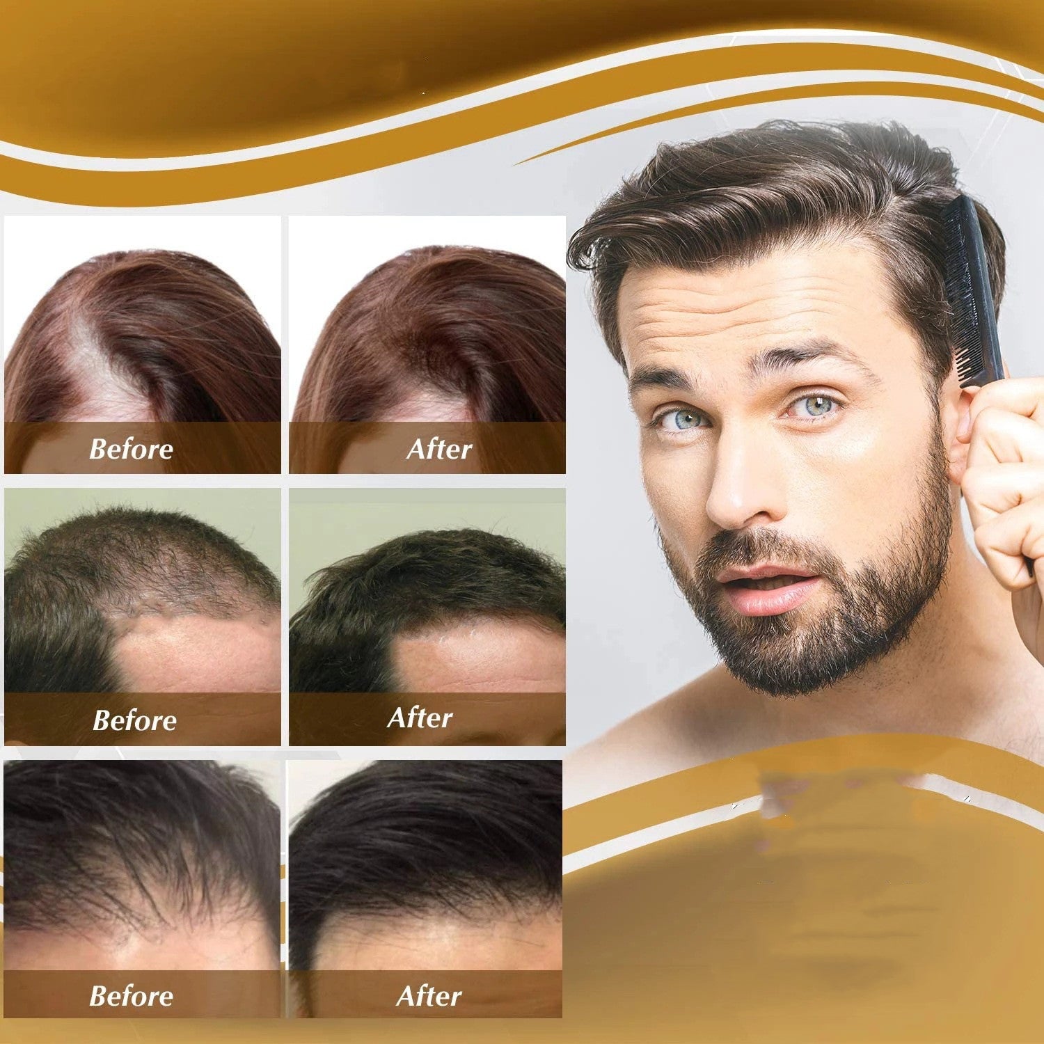 Anti Hair Loss Hair Nourishing Liquid Hair Firming And Hair Increasing - Fiti beautyhaircareCJJY161860001AZ